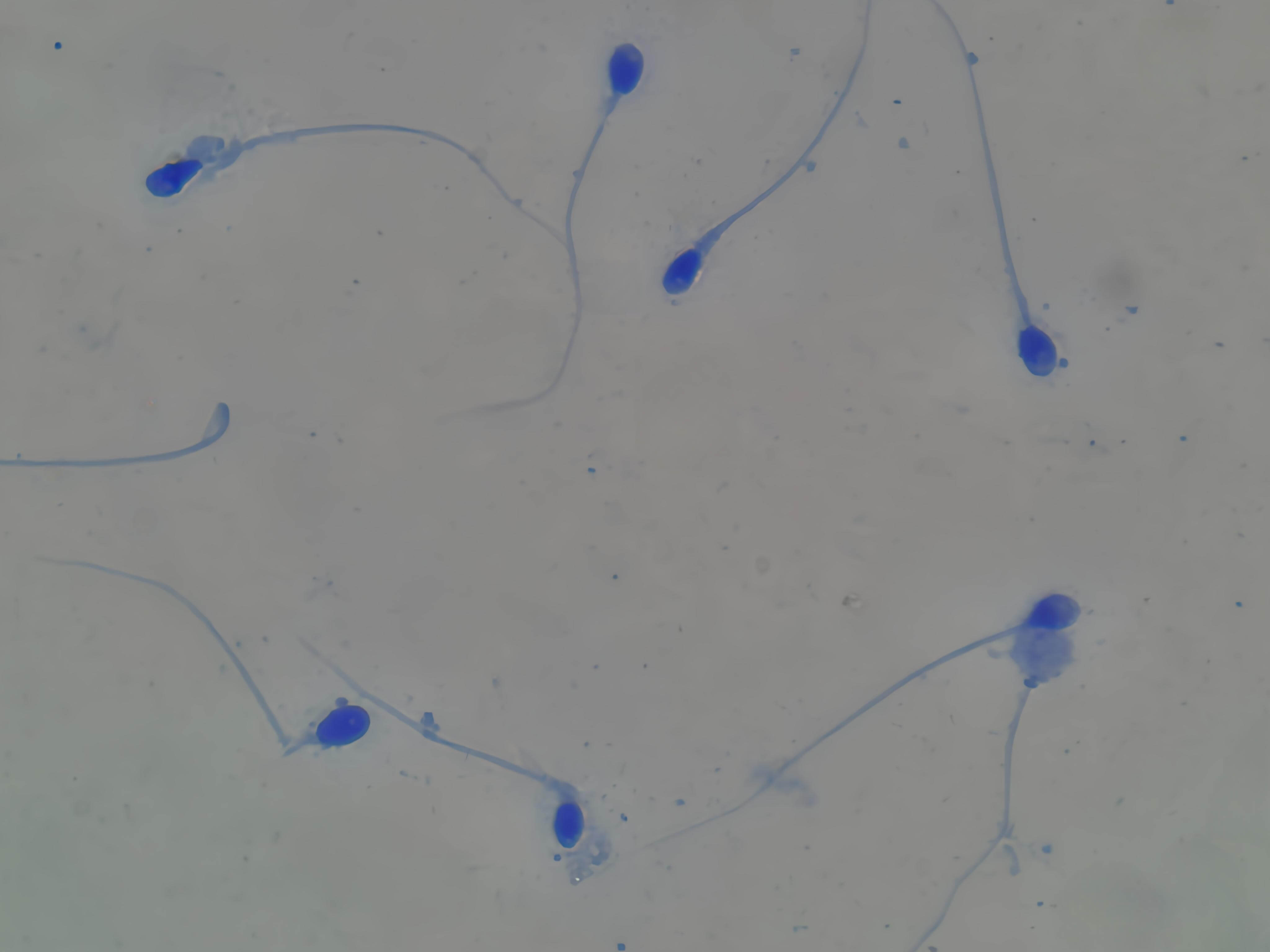 Pre-stained Sperm Morphology Quick Staining kit for laboratory analysis